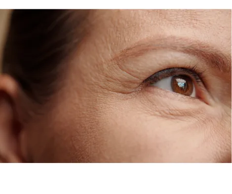 Linii fine in jurul ochilor - ingrijire anti-aging cu ingrediente naturale